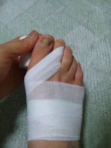 足指の包帯の巻き方-この場合は人差し指を巻きます。包帯の幅が広い場合は折って調節します。