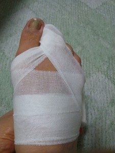 足指の包帯の巻き方-目的の指と隣の指を巻いて足の甲側を通して巻きます。