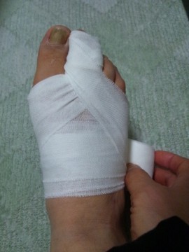 足指の包帯の巻き方-必要に応じ繰り返し麦穂帯（8字に巻く巻き方）を繰り返します。