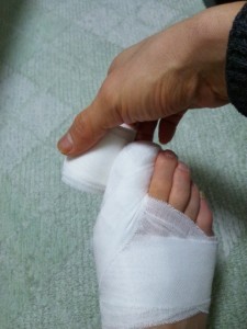 足の指先を覆う包帯の巻き方-斜めに折り、折ったところを親指でしっかりと押さえ絶対にずらしてはいけません。