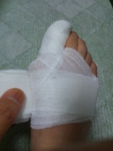 足の指先を覆う包帯の巻き方-