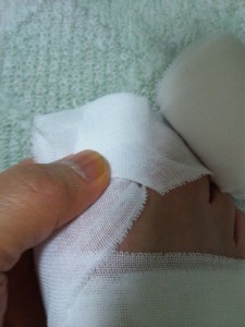 足の指先を覆う包帯の巻き方-斜めに折り、折ったところを親指でしっかりと押さえ絶対にずらしてはいけません。