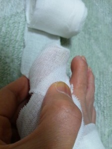 足の指先を覆う包帯の巻き方-押さえた指は緩めたりずらしてはいけません。