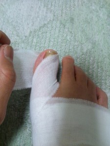 足の指先を覆う包帯の巻き方-指を一周巻いて行きます。