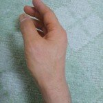 手の親指の包帯の巻き方